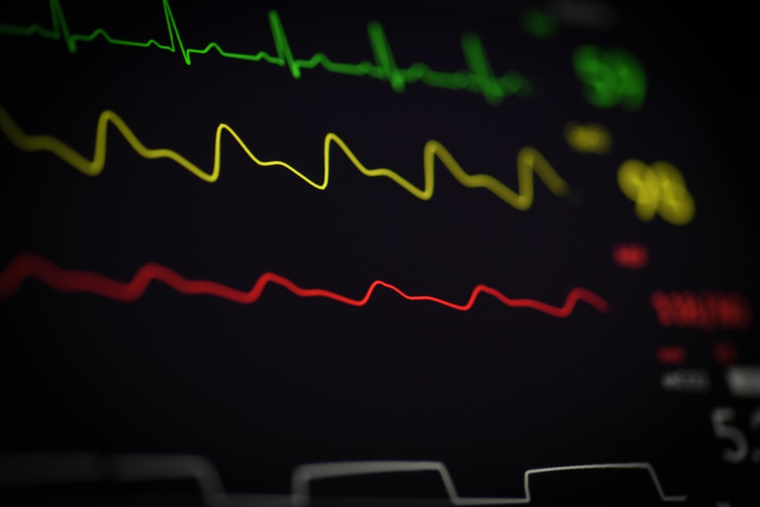 Photo ecg