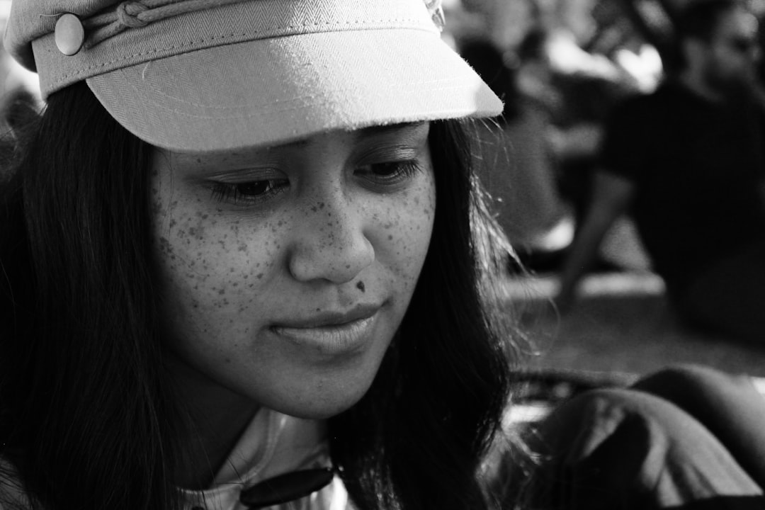 Photo freckles